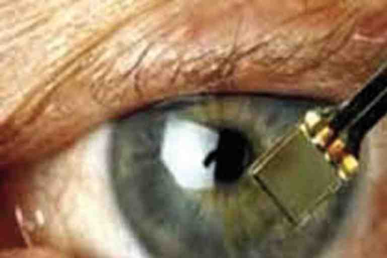 اعتماد تقنية حديثة في عمليات زرع القرنية