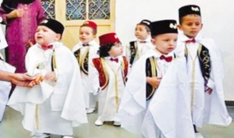 برمجة ختان 600 طفل  خلال رمضان