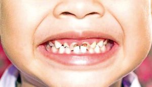 اختتام الأسبوع الإعلامي بسكيكدة