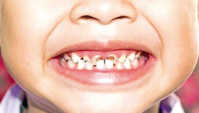 اختتام الأسبوع الإعلامي بسكيكدة