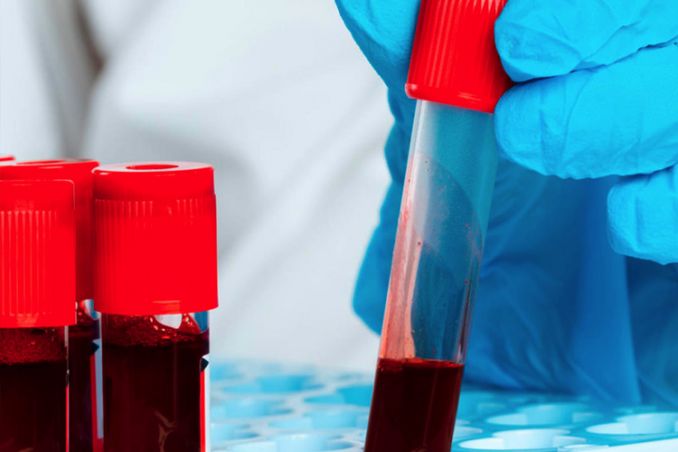 أسباب ارتفاع كريات الدم الحمراء للحامل