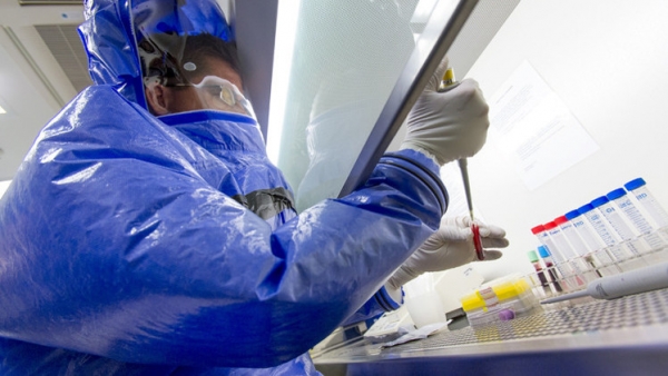 علماء روس يبتكرون لقاحا تجريبيا ضد فيروس ”إيبولا”