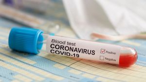 13 وفاة و831 إصابة جديدة وتماثل 452 مريض للشفاء