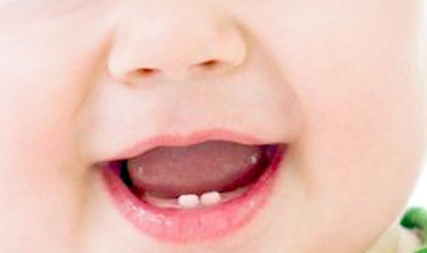 متى تظهر الأسنان الأولى للطفل؟