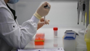 لا حالة وفاة .. 12 إصابة جديدة وشفاء 10 مرضى