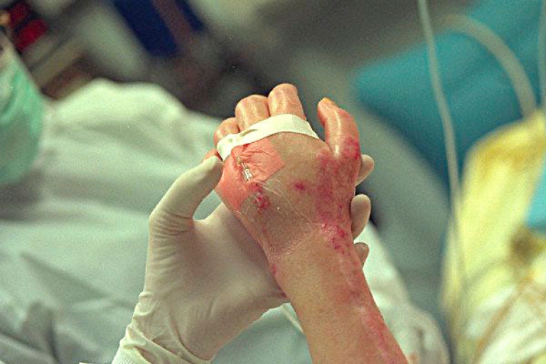 الحماية المدنية تطلق حملة وقائية من أخطار المفرقعات