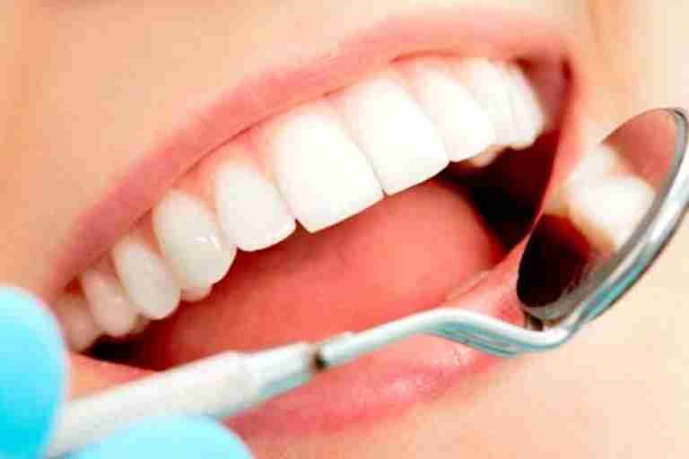 نقص كبير في التكفل بطب الأسنان المدرسي