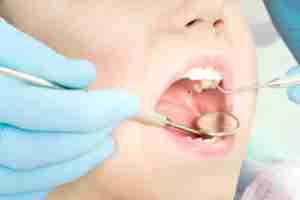 فتح 5 وحدات طبية متخصصة في جراحة الأسنان