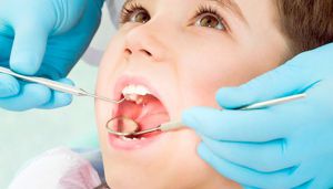 160 ألف تلميذ مصابون بتسوس الأسنان