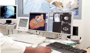 نقص فادح في تخصصات أمراض القلب والأشعة