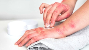 استقبال نصف مليون مصاب في 2023