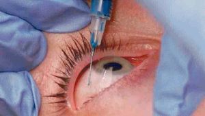جراحة العيون