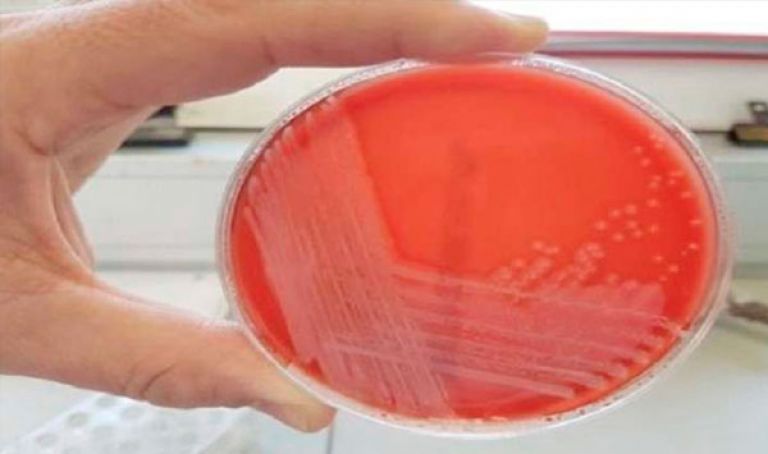 اكتشاف نوع غير معروف من البكتيريا!