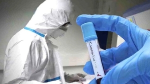 وفاتان.. 38 إصابة جديدة وشفاء 37 مريضا