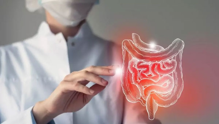 ألف إصابة جديدة بداء القولون التقرحي