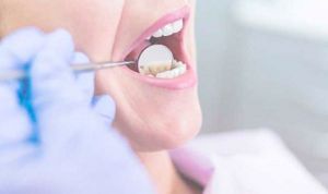 تسجيل 4 آلاف حالة تسوس أسنان