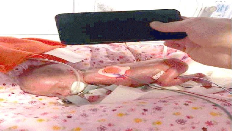رضيعة "معجزة" بحجم هاتف "آيفون"